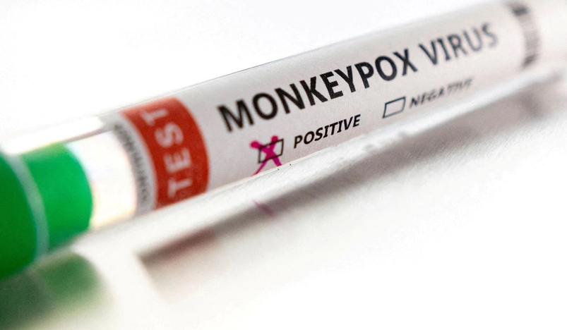 Monkeypox Test tube